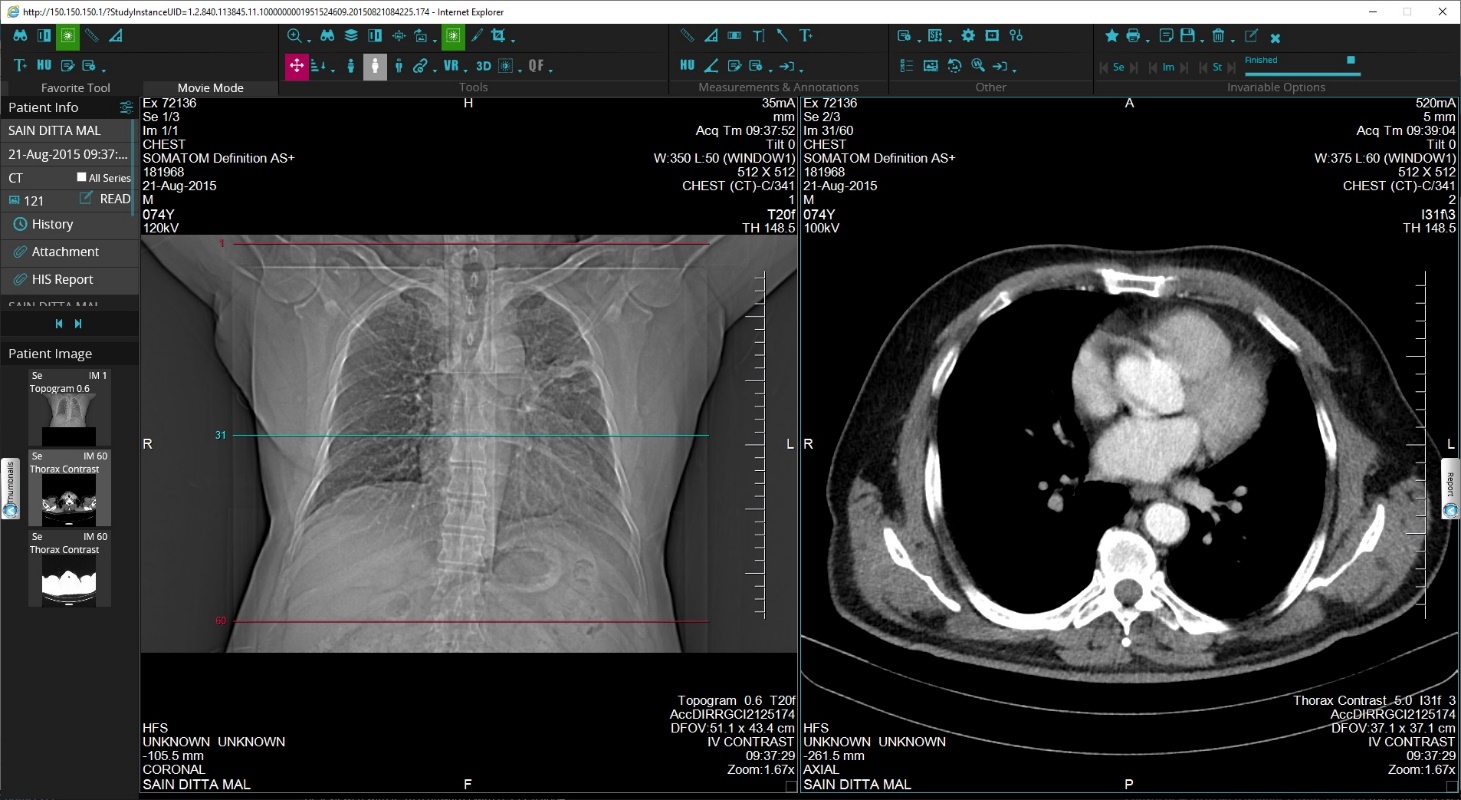 Medsynapse PACS Software - Salinee Healthcare